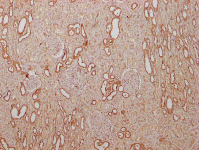 PKM Antibody in Immunohistochemistry (Paraffin) (IHC (P))