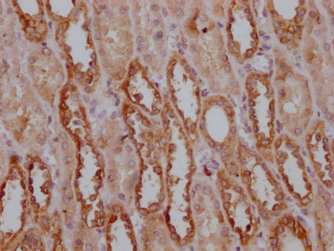 PKM Antibody in Immunohistochemistry (Paraffin) (IHC (P))