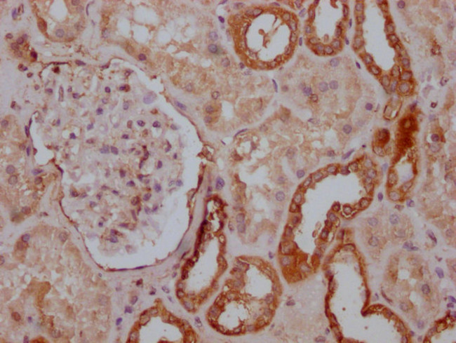 PKM Antibody in Immunohistochemistry (Paraffin) (IHC (P))