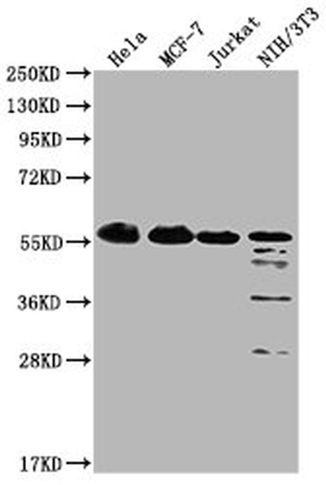 PKM Antibody in Western Blot (WB)