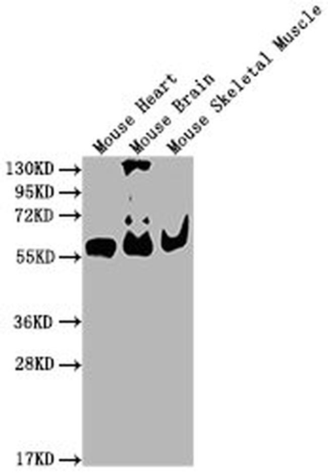 PKM Antibody in Western Blot (WB)