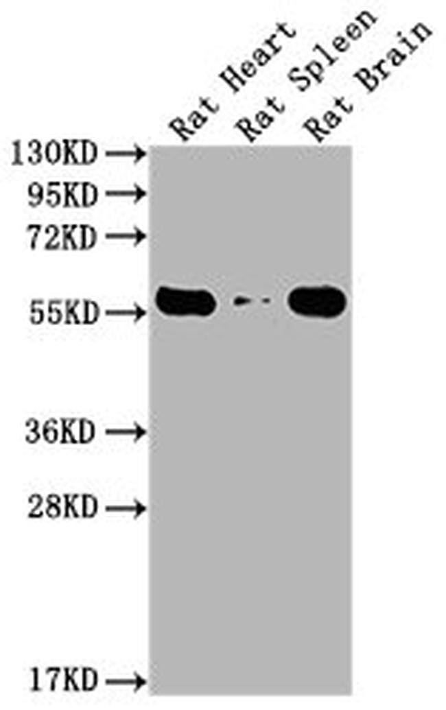 PKM Antibody in Western Blot (WB)