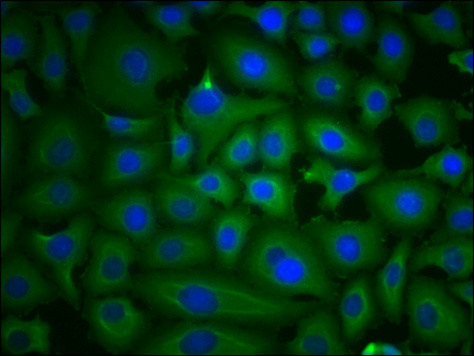 PKM Antibody in Immunocytochemistry (ICC/IF)