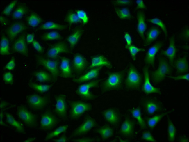 PKM Antibody in Immunocytochemistry (ICC/IF)