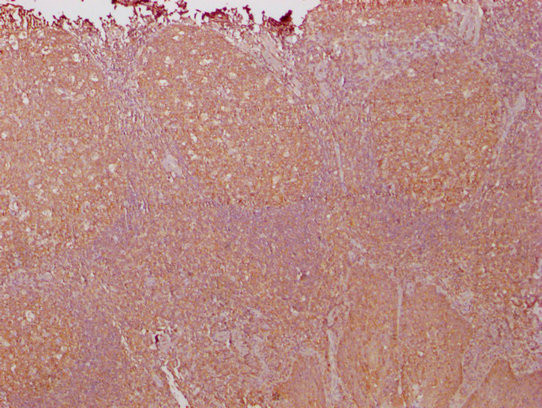 PKM Antibody in Immunohistochemistry (Paraffin) (IHC (P))