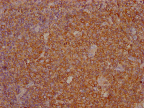 PKM Antibody in Immunohistochemistry (Paraffin) (IHC (P))