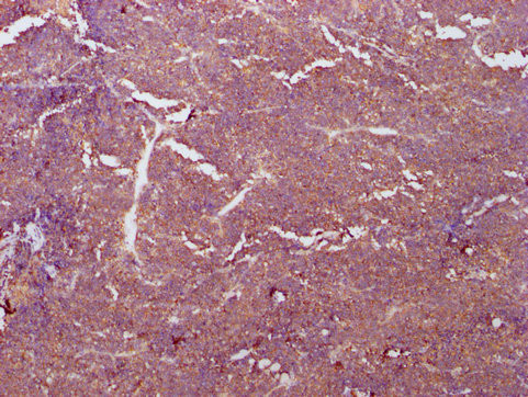 PKM Antibody in Immunohistochemistry (Paraffin) (IHC (P))