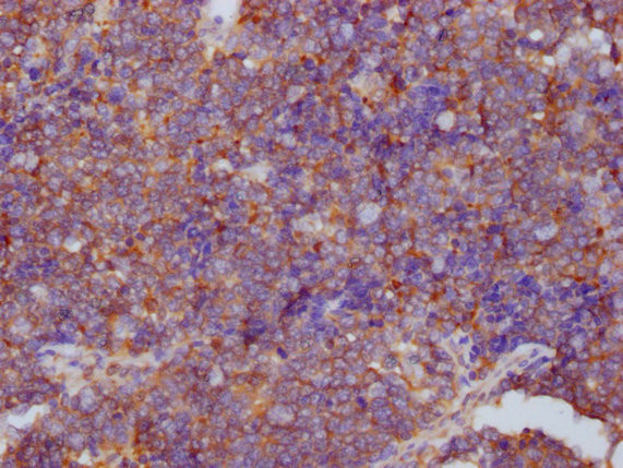 PKM Antibody in Immunohistochemistry (Paraffin) (IHC (P))