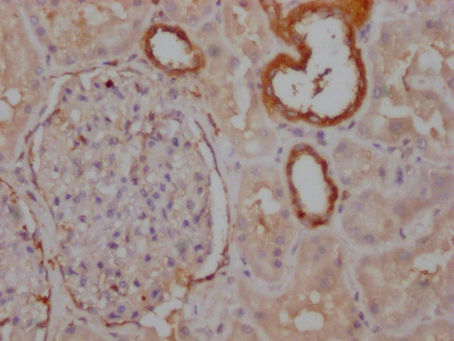 PKM Antibody in Immunohistochemistry (Paraffin) (IHC (P))