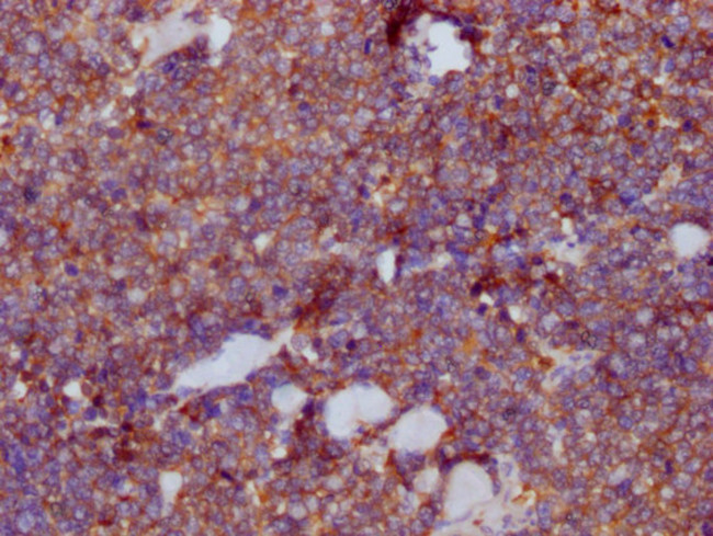 PKM Antibody in Immunohistochemistry (Paraffin) (IHC (P))