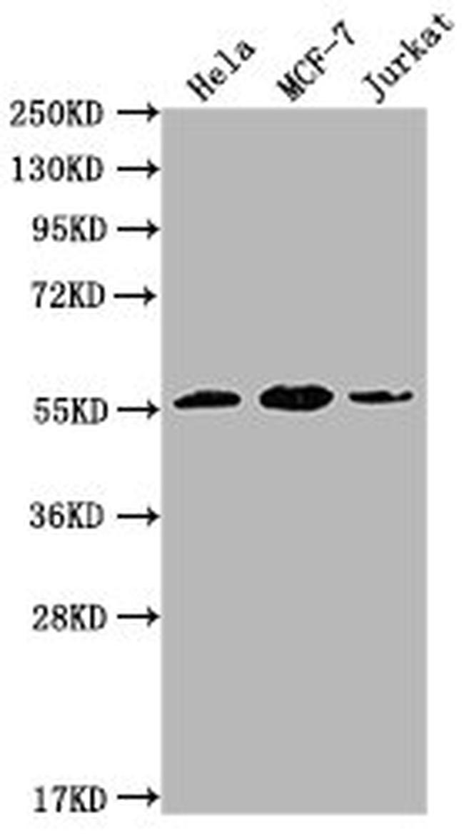 PKM Antibody in Western Blot (WB)