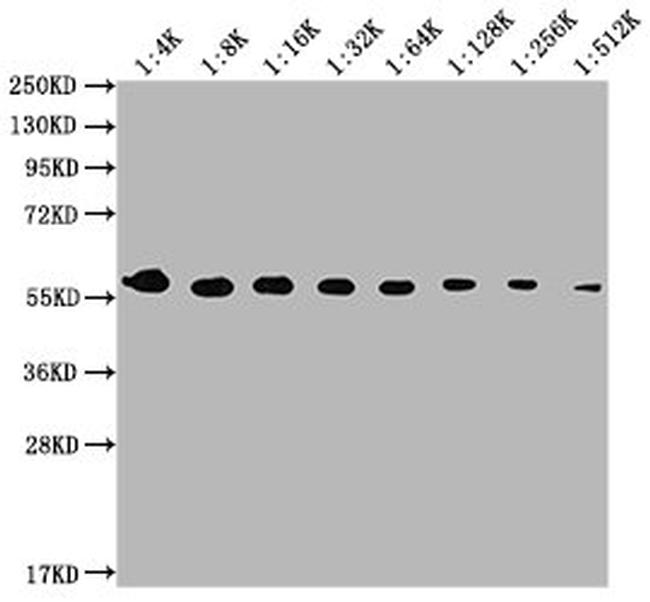 PKM Antibody in Western Blot (WB)