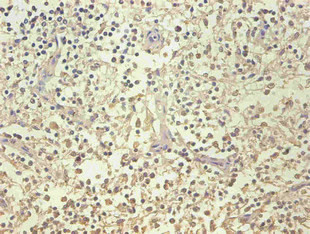 NGAL Antibody in Immunohistochemistry (Paraffin) (IHC (P))