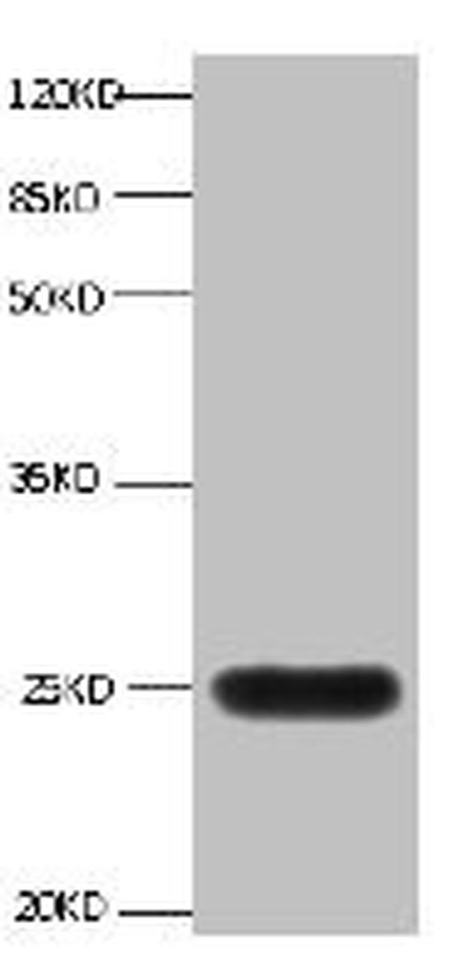 NGAL Antibody in Western Blot (WB)