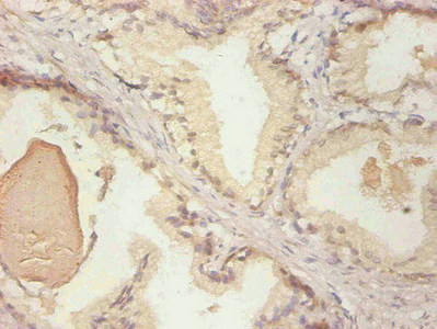 NGAL Antibody in Immunohistochemistry (Paraffin) (IHC (P))