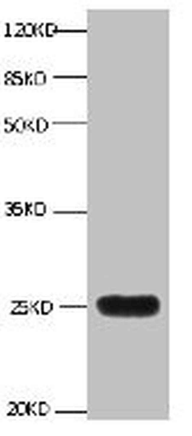 NGAL Antibody in Western Blot (WB)