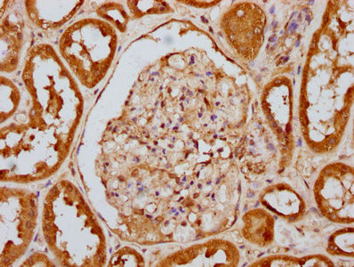 Phospho-PKR (Thr446) Antibody in Immunohistochemistry (Paraffin) (IHC (P))