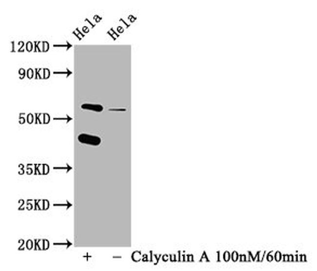 Phospho-PKR (Thr446) Antibody in Western Blot (WB)