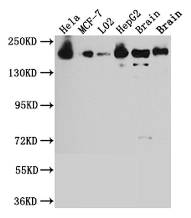 ROCK2 Antibody in Western Blot (WB)