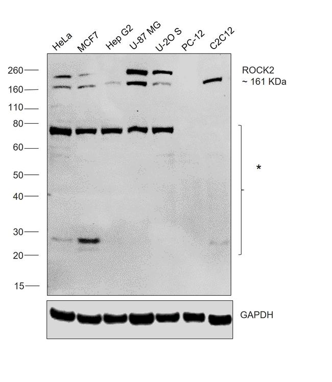 ROCK2 Antibody in Western Blot (WB)