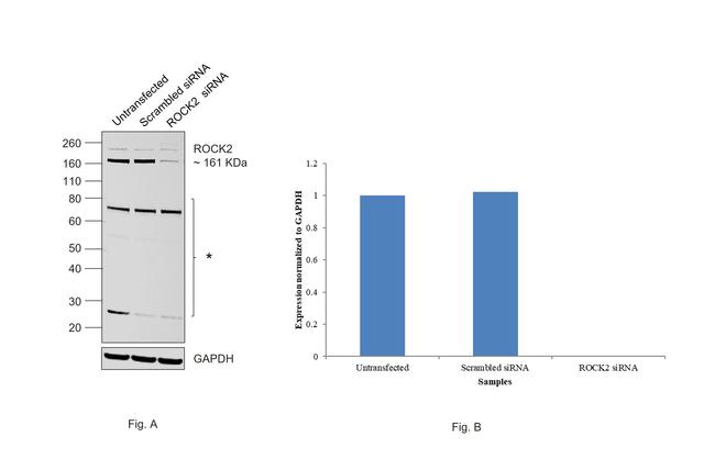 ROCK2 Antibody in Western Blot (WB)