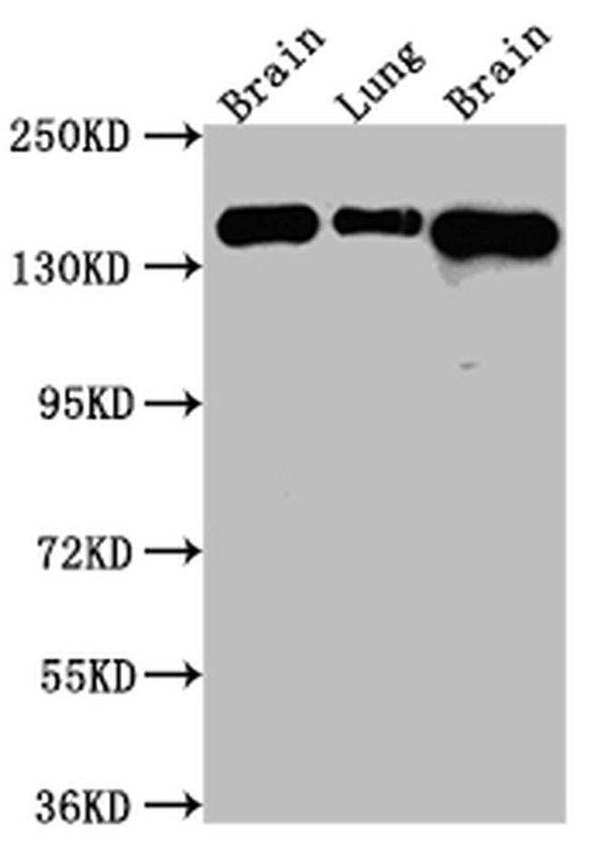 FGFR2 Antibody in Western Blot (WB)