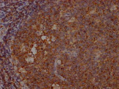 SHIP1 Antibody in Immunohistochemistry (Paraffin) (IHC (P))