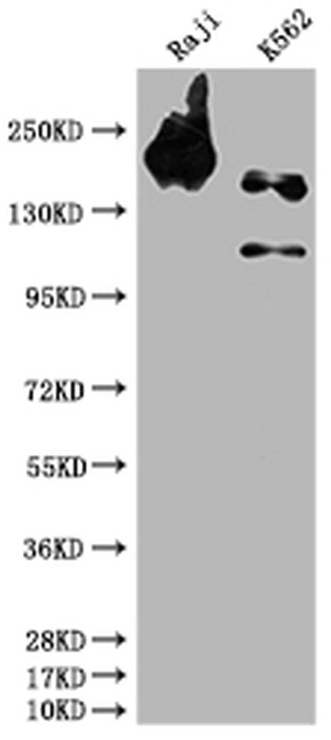 SHIP1 Antibody in Western Blot (WB)