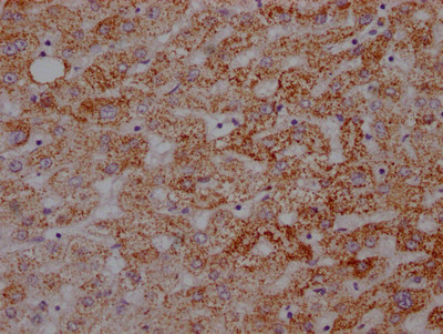 ATP5A1 Antibody in Immunohistochemistry (Paraffin) (IHC (P))