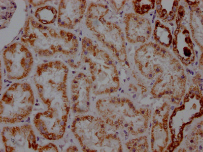 ATP5A1 Antibody in Immunohistochemistry (Paraffin) (IHC (P))