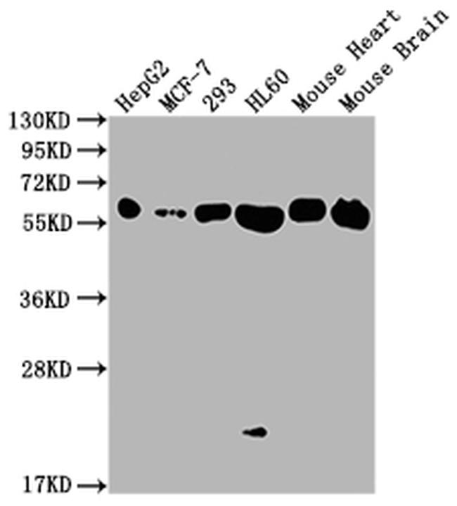 ATP5A1 Antibody in Western Blot (WB)