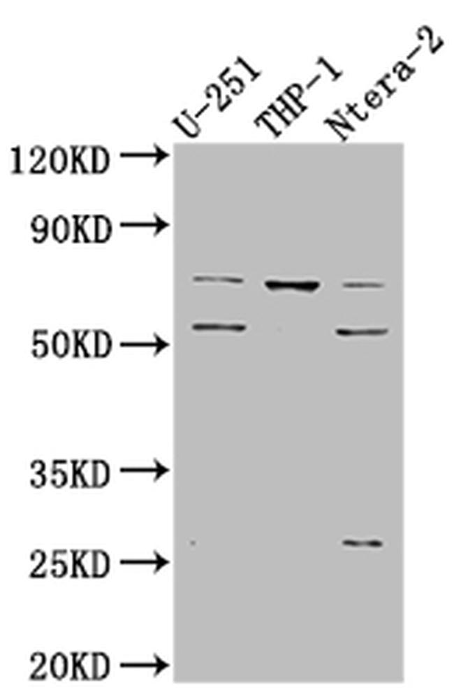 PTH1R Antibody in Western Blot (WB)