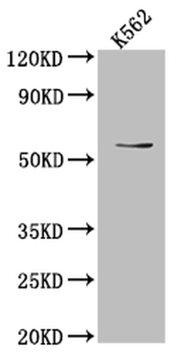 UAP1 Antibody in Western Blot (WB)