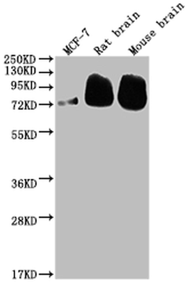 BACE1 Antibody in Western Blot (WB)