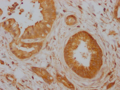 Cdc42 Antibody in Immunohistochemistry (Paraffin) (IHC (P))