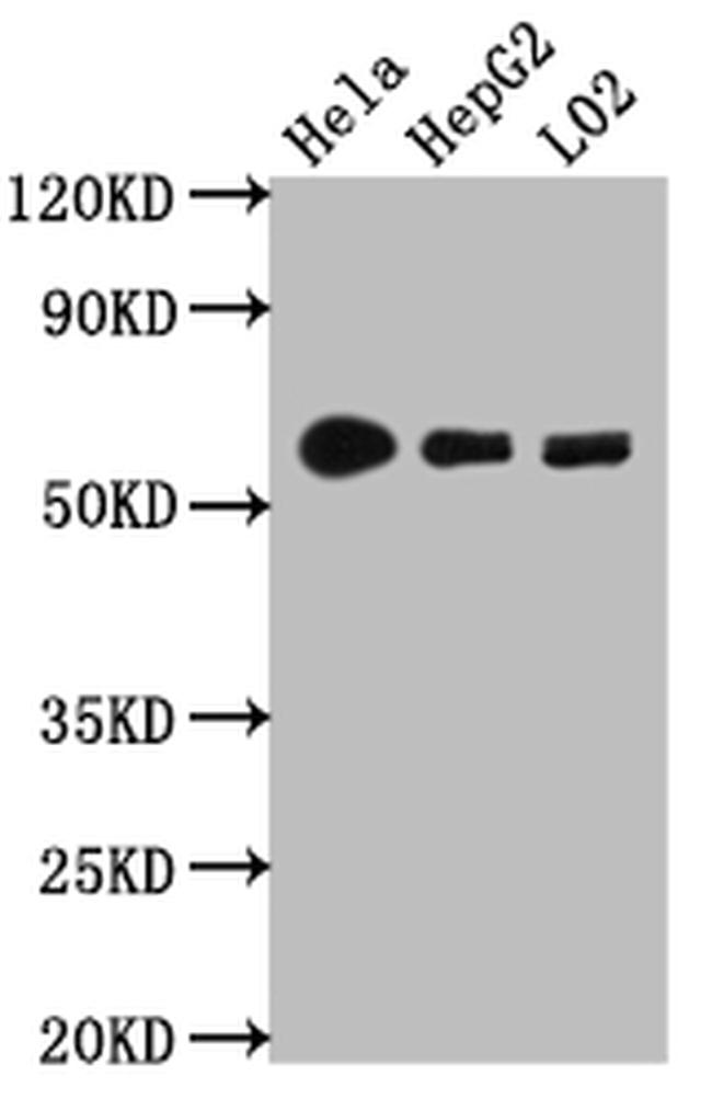 CYP1A2 Antibody in Western Blot (WB)