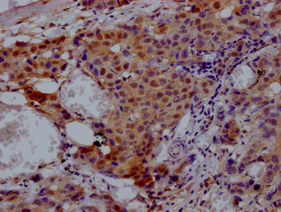 VCP Antibody in Immunohistochemistry (Paraffin) (IHC (P))