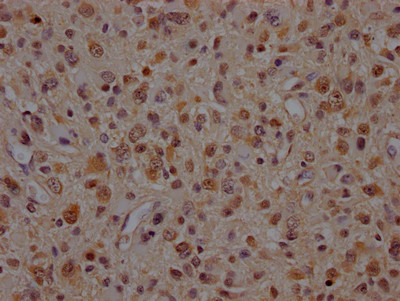 VCP Antibody in Immunohistochemistry (Paraffin) (IHC (P))