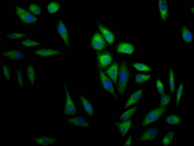 ERK2 Antibody in Immunocytochemistry (ICC/IF)