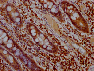 ERK2 Antibody in Immunohistochemistry (Paraffin) (IHC (P))