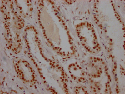 USP7 Antibody in Immunohistochemistry (Paraffin) (IHC (P))