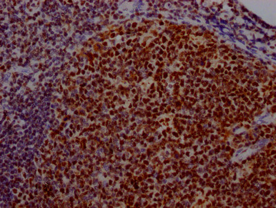 USP7 Antibody in Immunohistochemistry (Paraffin) (IHC (P))