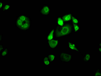 KLF4 Antibody in Immunocytochemistry (ICC/IF)