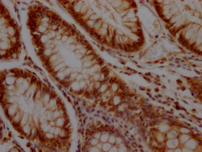 KLF4 Antibody in Immunohistochemistry (Paraffin) (IHC (P))