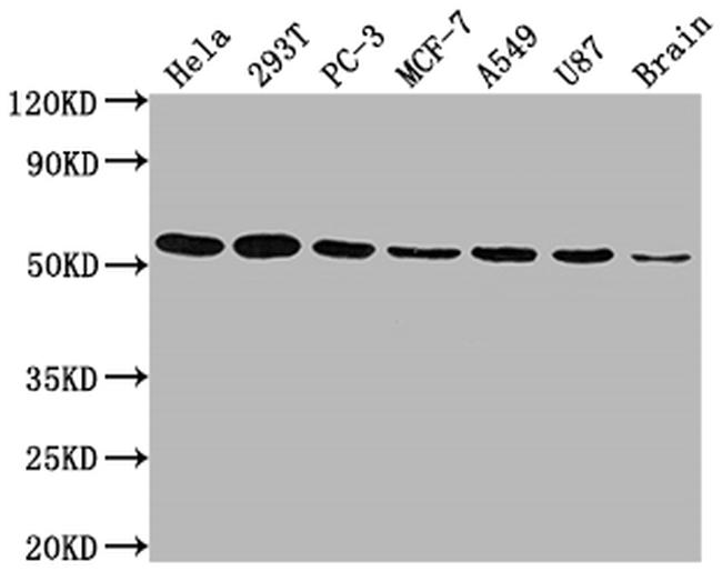 KLF4 Antibody in Western Blot (WB)