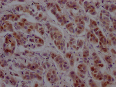 GATA3 Antibody in Immunohistochemistry (Paraffin) (IHC (P))