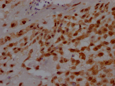 GATA3 Antibody in Immunohistochemistry (Paraffin) (IHC (P))