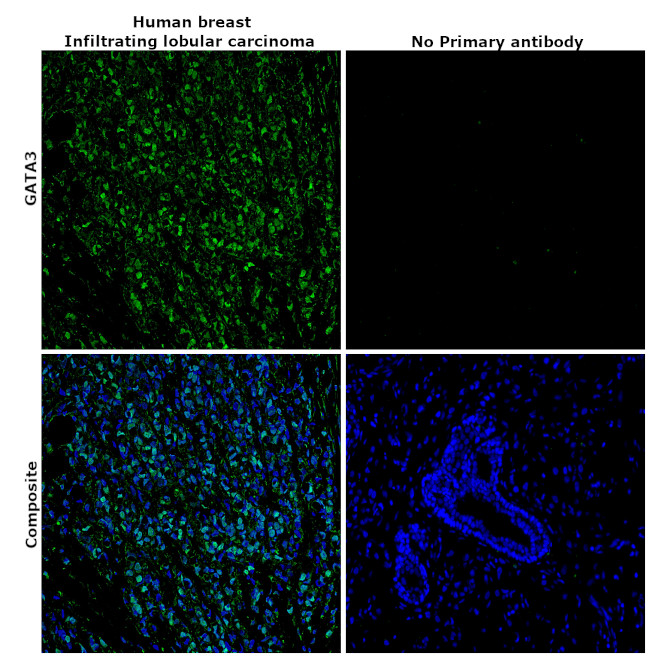 GATA3 Antibody in Immunohistochemistry (Paraffin) (IHC (P))