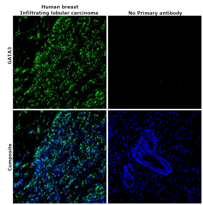 GATA3 Antibody in Immunohistochemistry (Paraffin) (IHC (P))