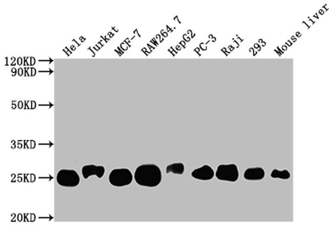 TPT1 Antibody in Western Blot (WB)